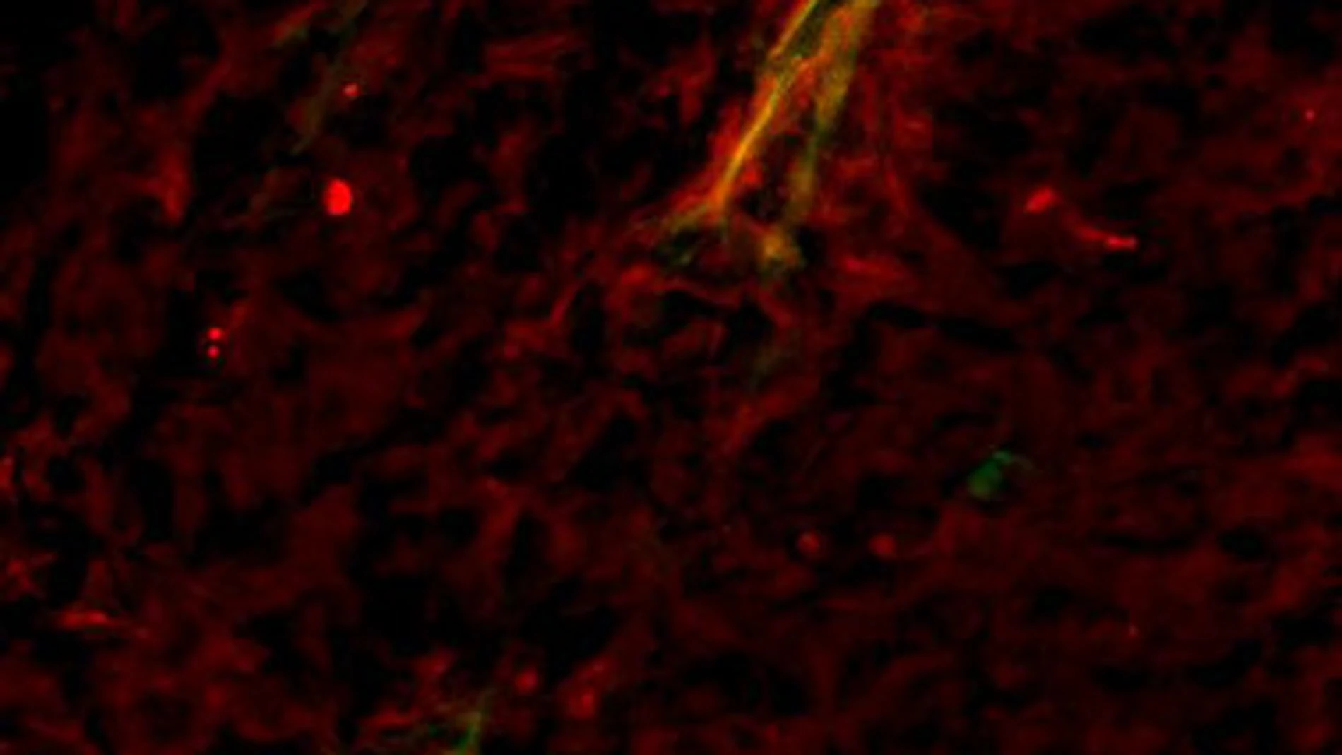 Detección de óxido nítrico (en rojo) cerca de los vasos sanguíneos (detectados mediante microangiografía; en verde) que irrigan un tumor, tras aumentar los niveles de SOD3. El amarillo indica la superposición de los dos colores