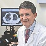 Dr. José María Echave-Sustaet / Jefe del Servicio de Neumología de Hospital Universitario Quirón Salud Madrid