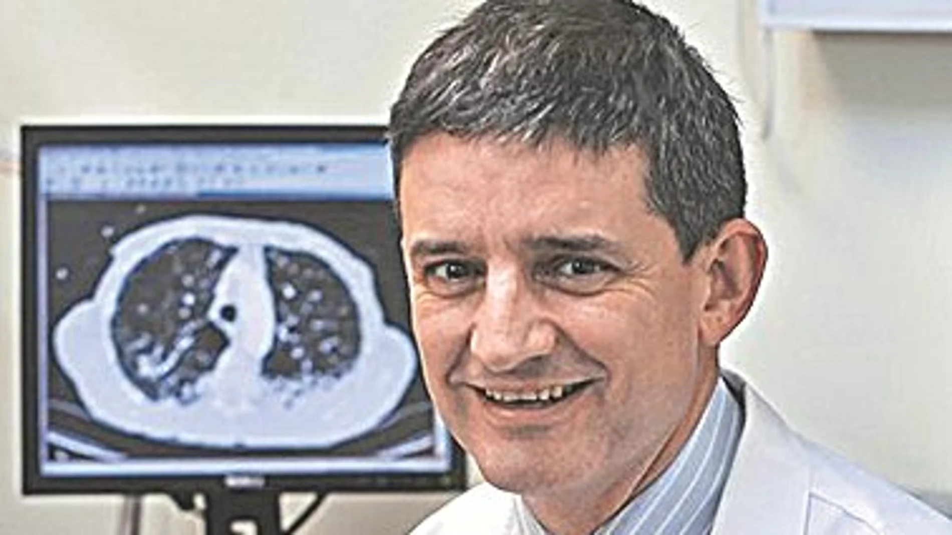 Dr. José María Echave-Sustaet / Jefe del Servicio de Neumología de Hospital Universitario Quirón Salud Madrid
