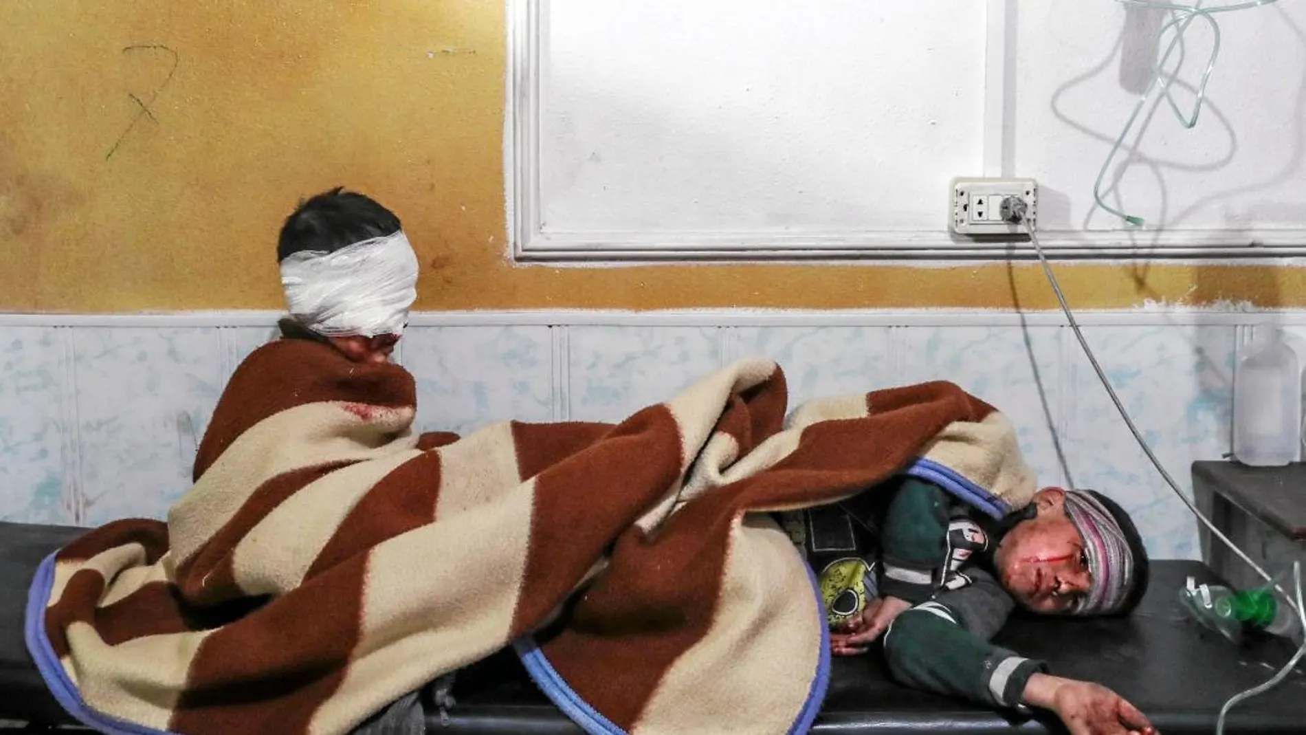 Dos de los menores sirios heridos en los últimos bombardeos se recuperan en un hospital de Mesraba, en Guta