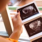 Mientras la ley protege los derechos reproductivos de los ciudadanos y no existe ninguna prohibición oficial que restrinja las vasectomías, ligaduras de trompas o abortos, tampoco las aprueba
