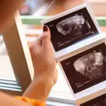  Un china, embarazada de gemelos a los 67 años rechaza abortar