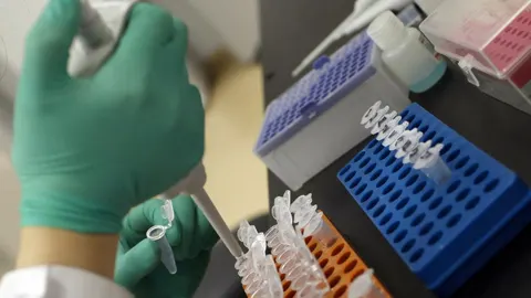 Sanidad propone a Europa crear una reserva del tratamiento contra la difteria