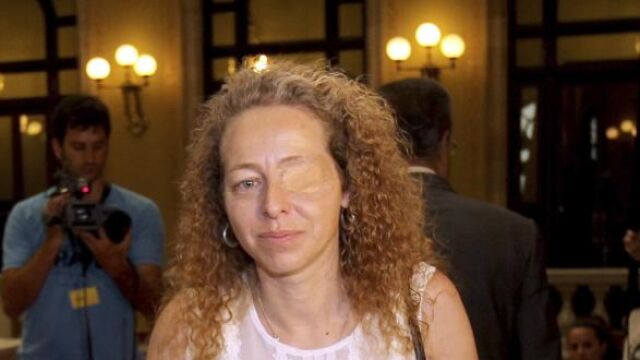 Esther Quintana, la mujer que perdió un ojo por el impacto de una pelota de goma.