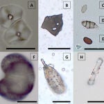 Microfósiles extraídos de la placa dental de individuos de la Cueva de Qesem (Israel)