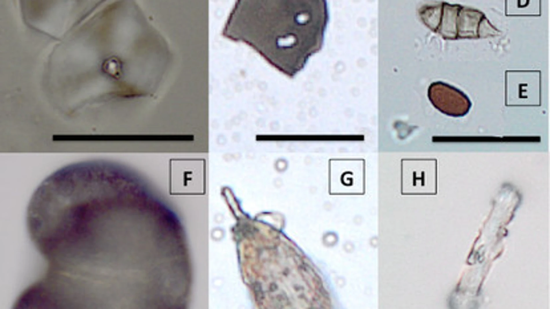 Microfósiles extraídos de la placa dental de individuos de la Cueva de Qesem (Israel)