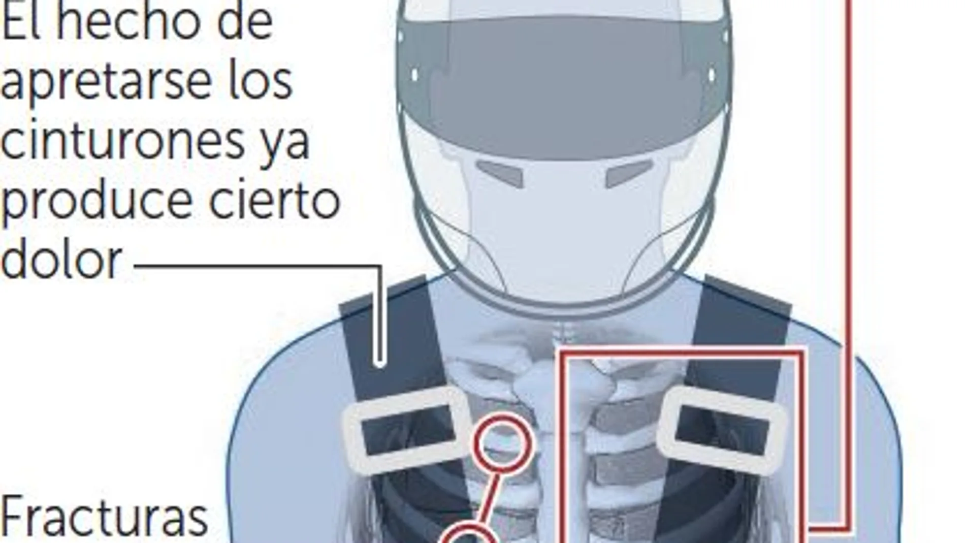 Una decisión razonable