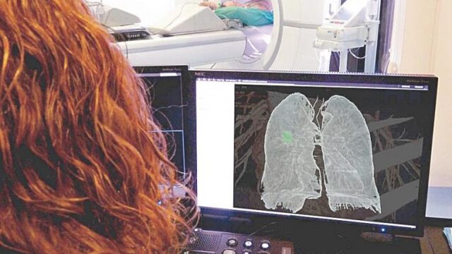 Expone al paciente a una dosis de radiación equivalente a una cuarta parte de la que recibe una persona de fuentes naturales durante un año