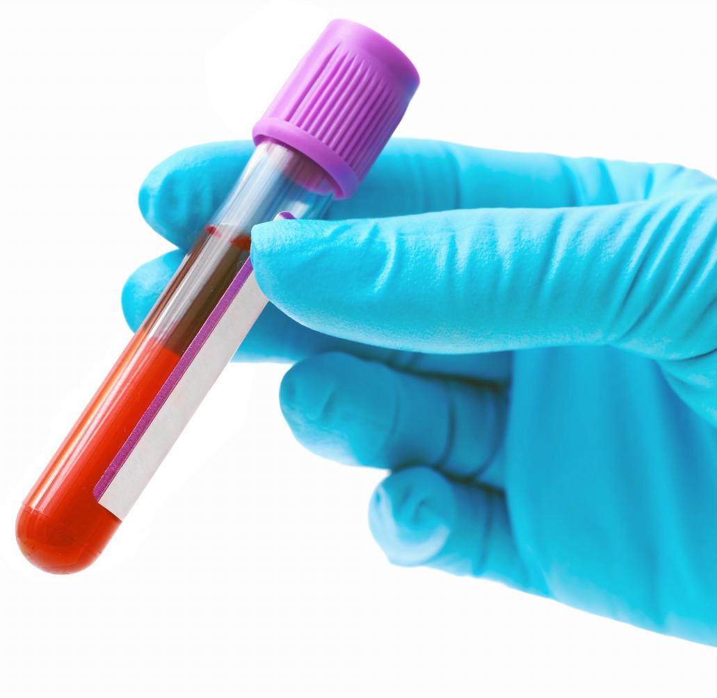 Un análisis de sangre contra el cáncer