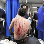 Un hombre sirio herido recibe primeros auxilios en un hospital de Damasco, donde más de 180 personas resultaron heridas en varias explosiones