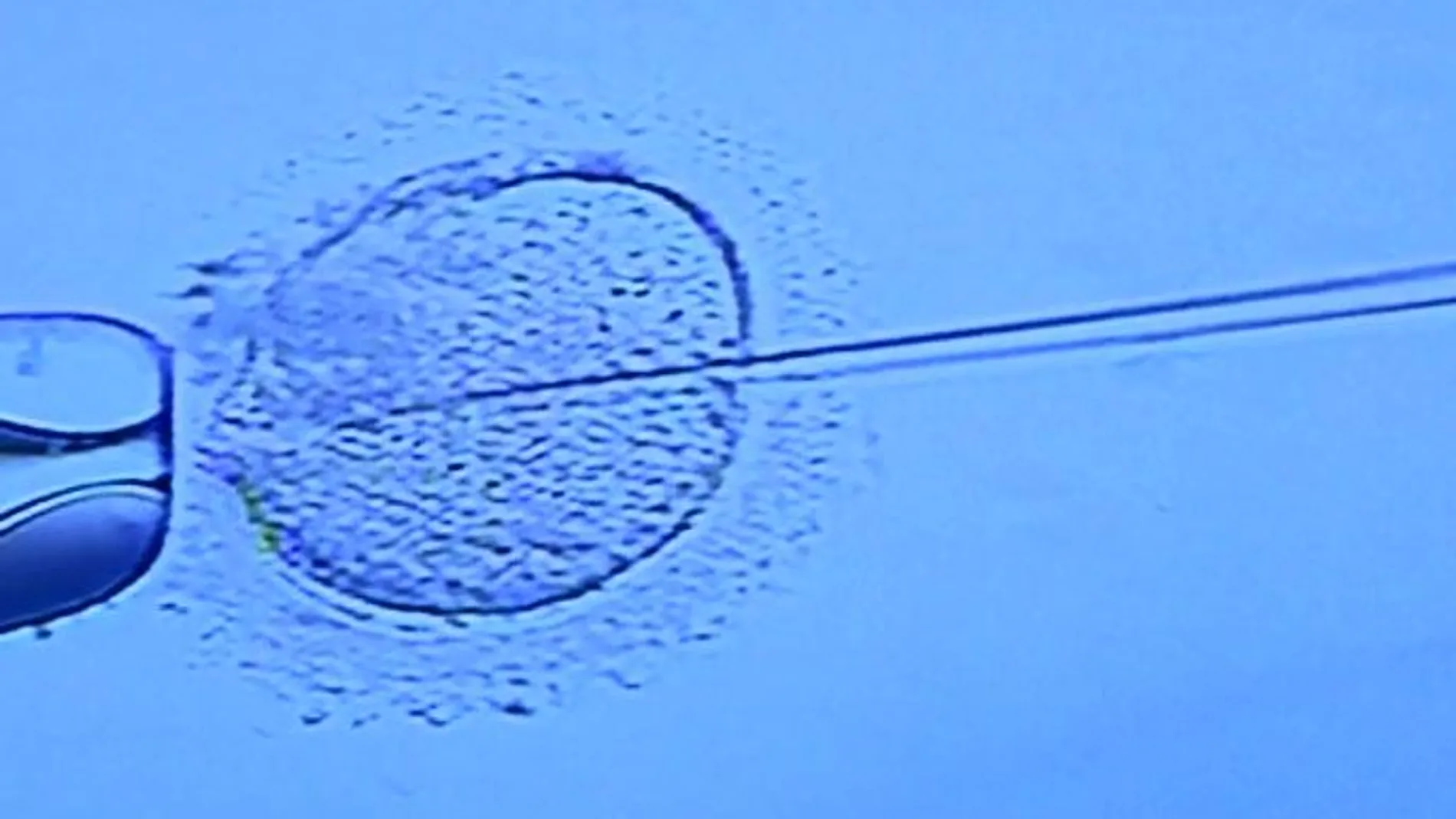 Transferir un único embrión, el reto para evitar los arriesgados embarazos múltiples