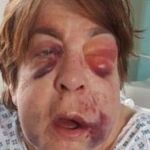 La mujer agredida por los dos jóvenes ingleses