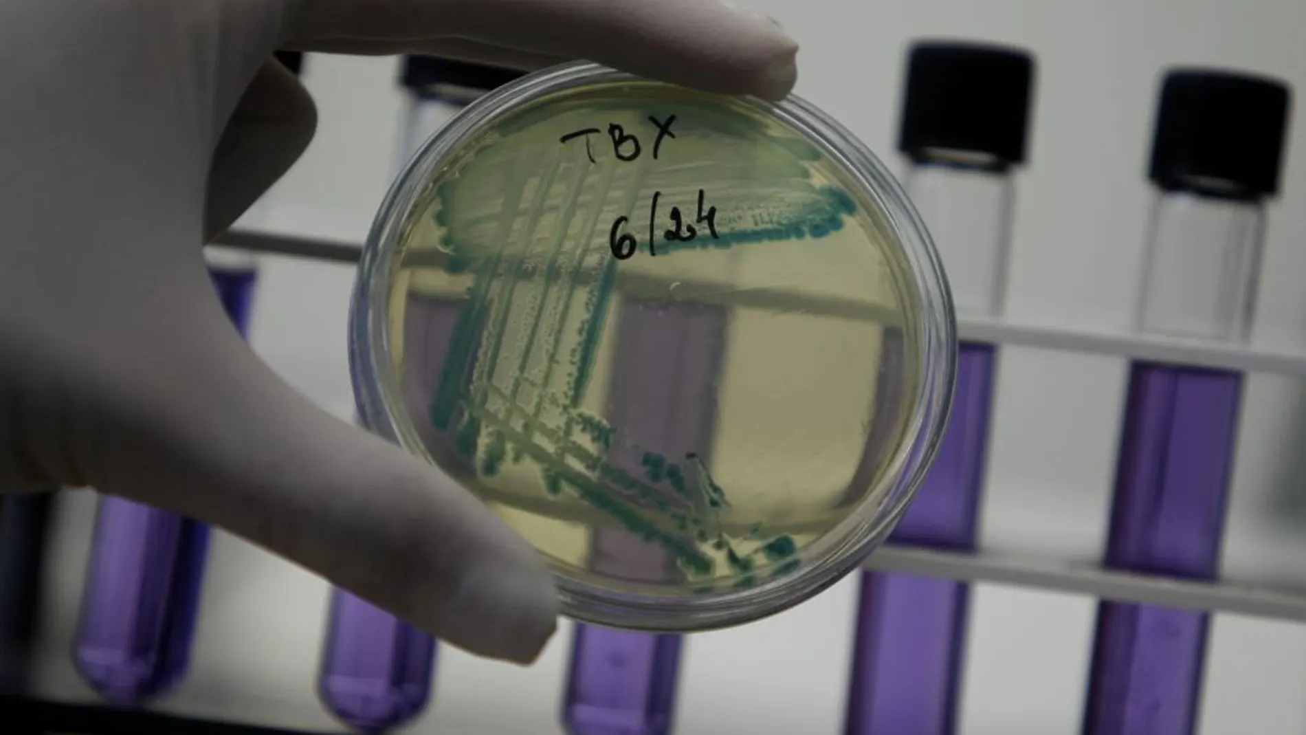 Muestras de la bacteria E. coli extraídas de un alimento