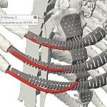 Diseñan una prótesis biomecánica a medida en 3D