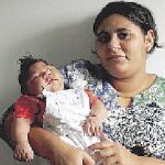 Una de las mujeres que dieron a luz a hijos con microcefalia tras padecer zika en Brasil.