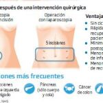 Intervenciones precisas