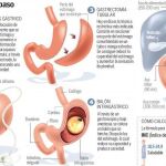 Tratamientos quirúrgicos paso a paso
