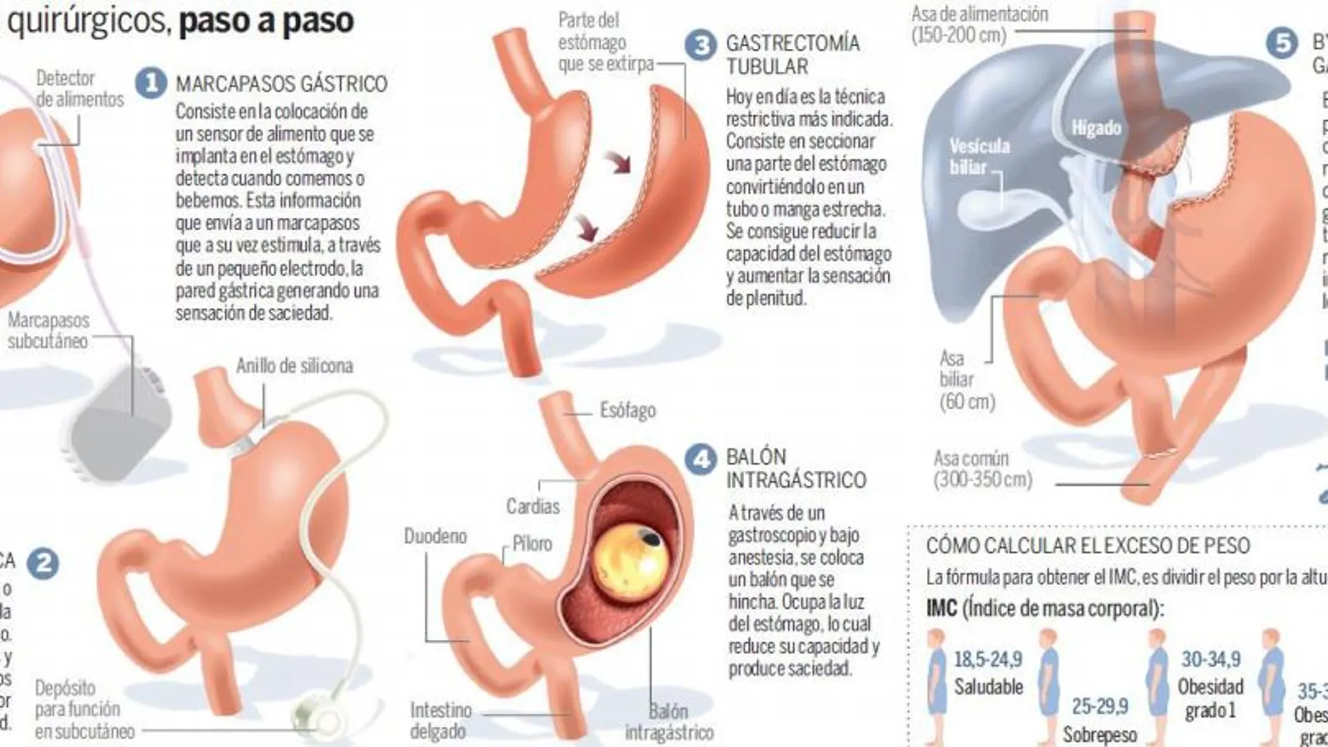 Tratamientos quirúrgicos paso a paso