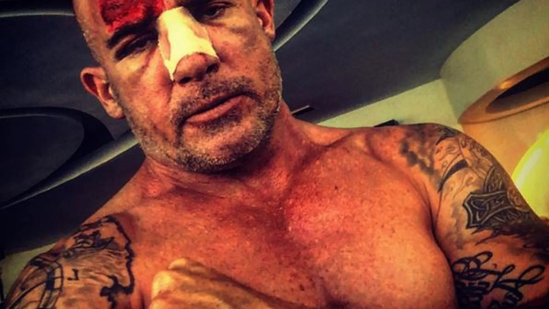 Dominic Purcell sufre graves lesiones durante el rodaje de Prison Break