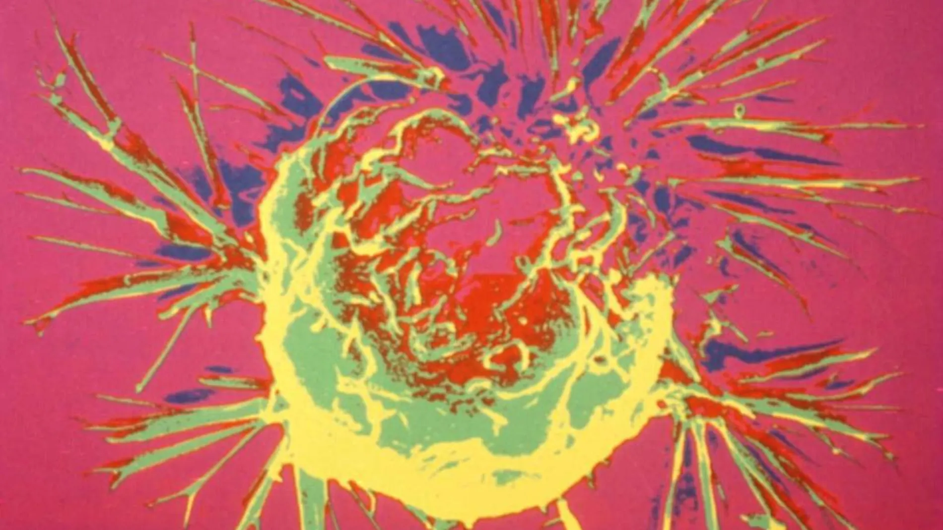 Una célula de un cáncer de pecho