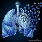  Nanofármacos para curar los pulmones