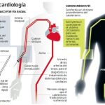 Tecnología de última generación en patologias cardiovasculares