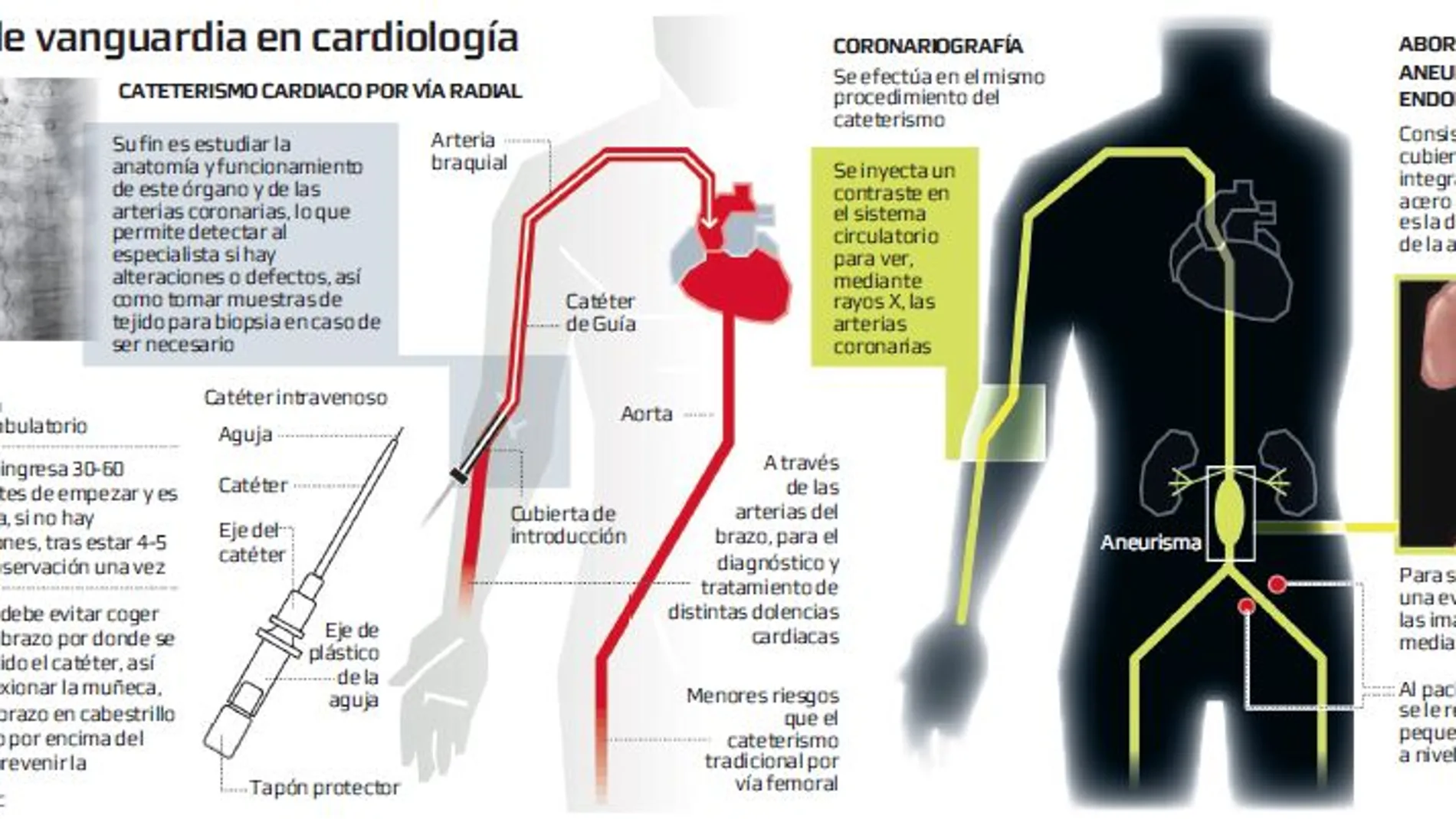 Tecnología de última generación en patologias cardiovasculares