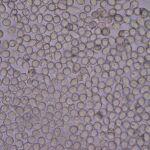 El estrés activa la médula ósea para producir glóbulos blancos, según el estudio