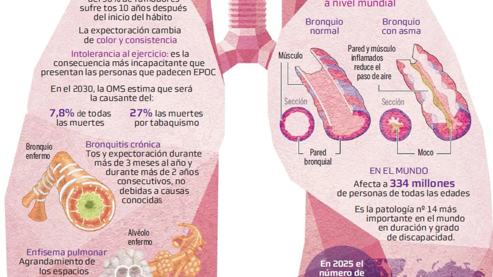 Gran impacto del asma grave en la vida cotidiana de los pacientes