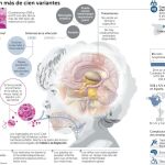 La variante más agresiva del enterovirus afecta ya a 60 niños en Cataluña