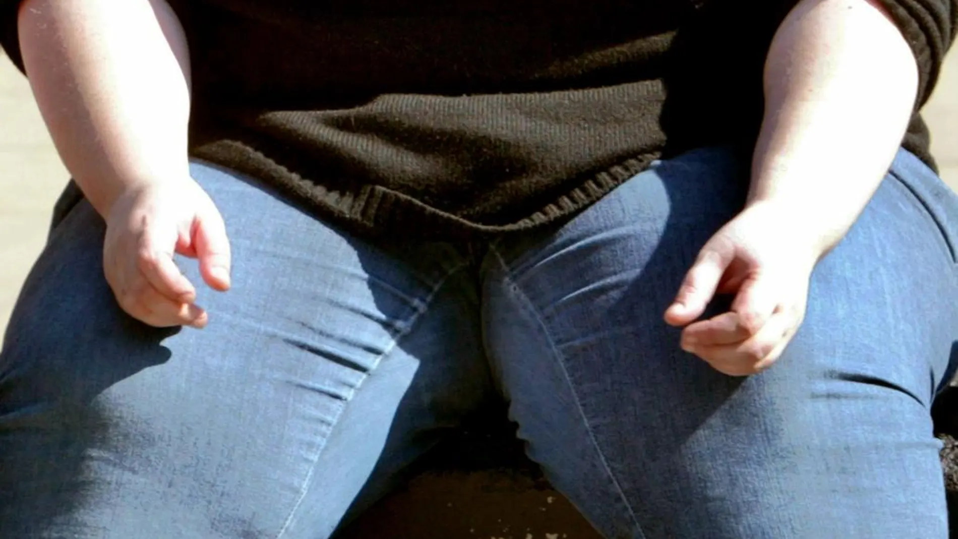 El hombre ha fallecido debido al deterioro de su salud por su exceso de peso