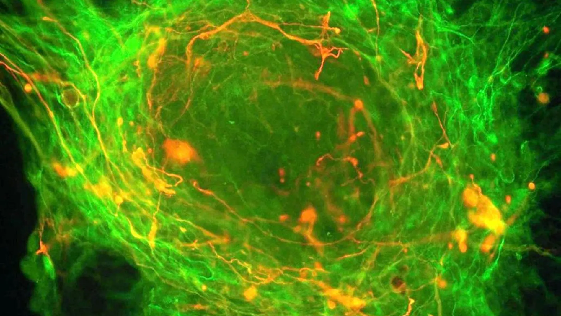 Una célula madre embrionaria, durante el proceso de conversión a neurona