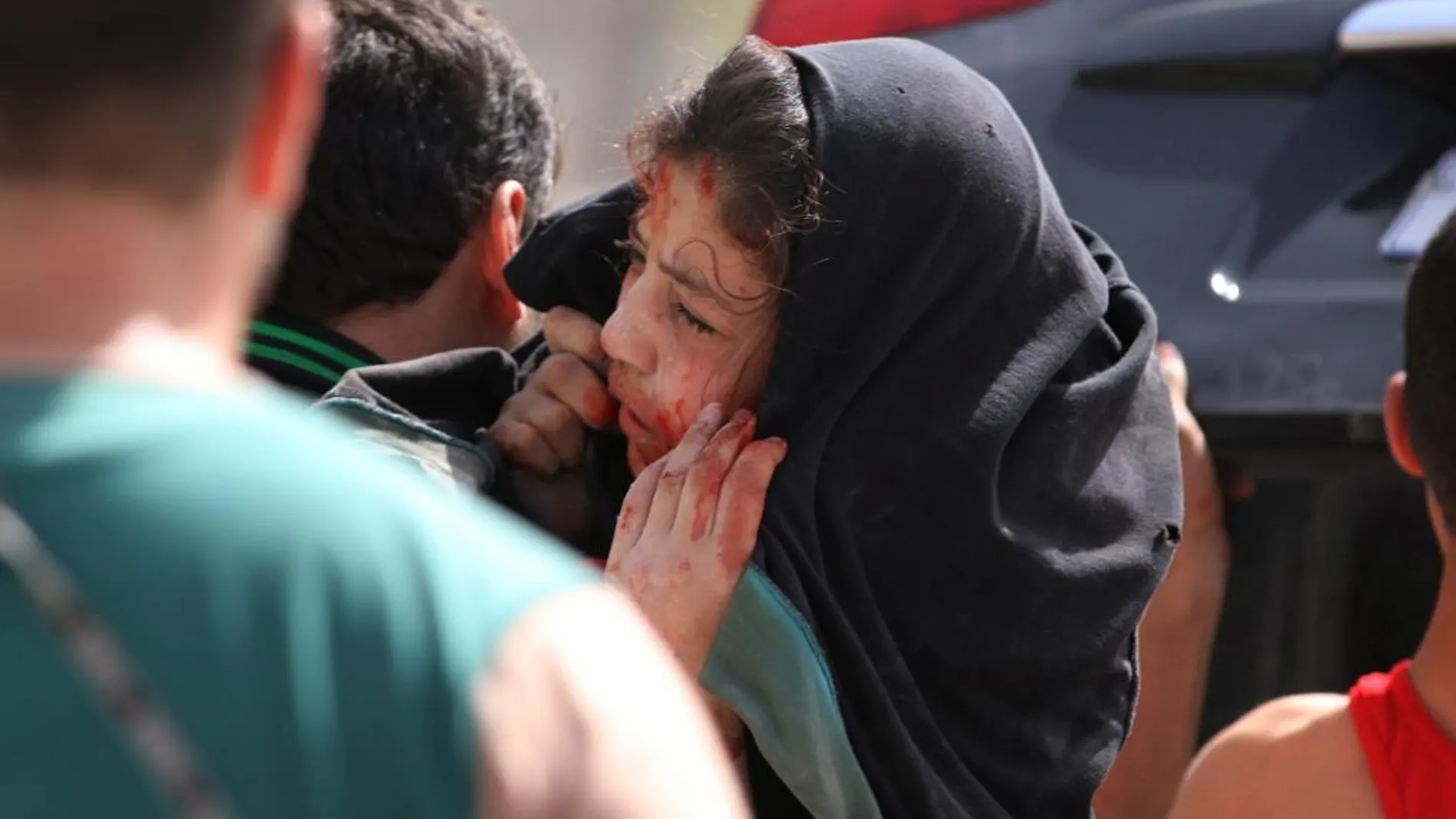 Un hombre traslada a un niña herida durante el bombardeo cerca de Alepo