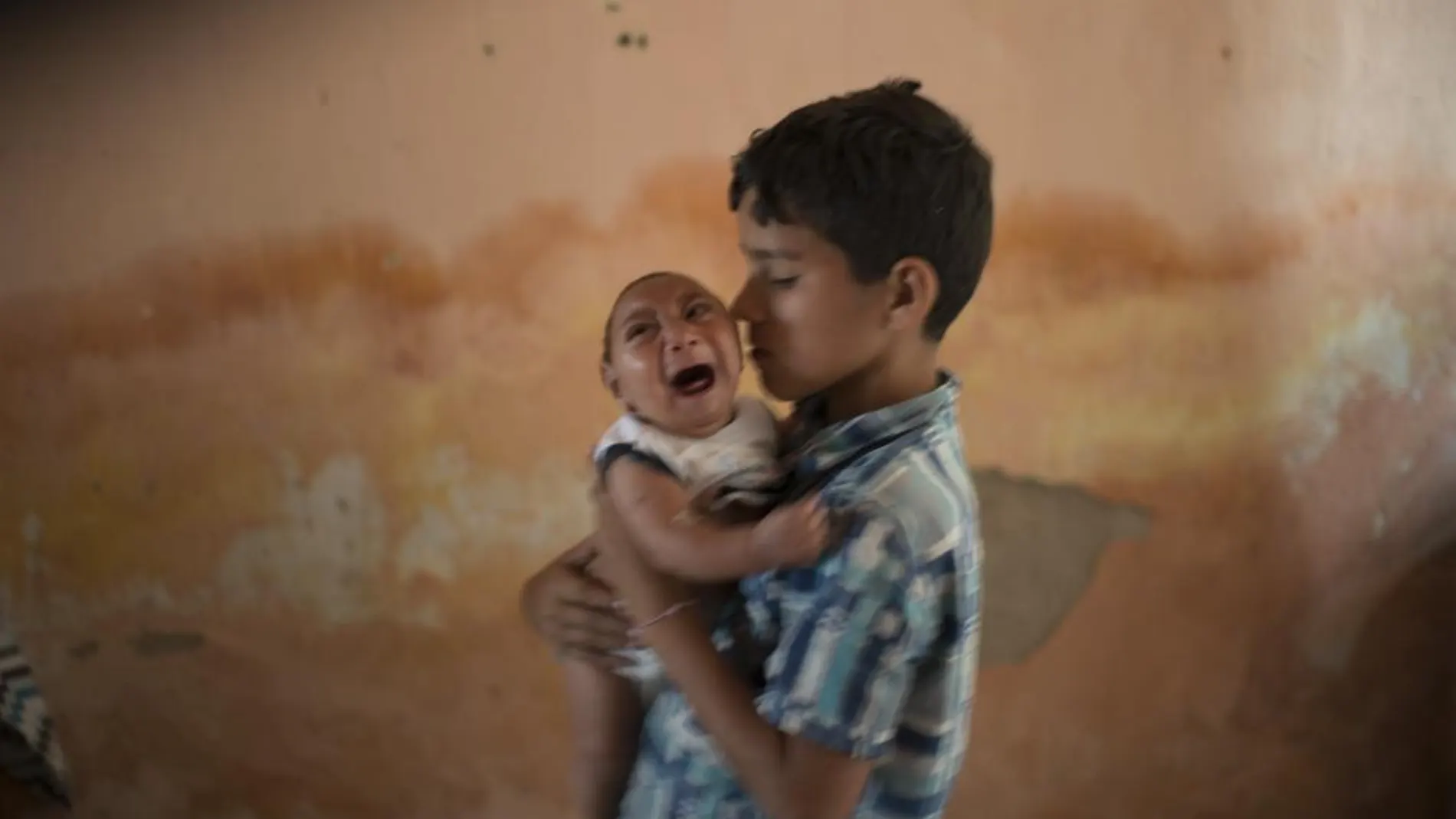 Un bebé con microcefalia, fotografiado el pasado mes de diciembre en Brasil