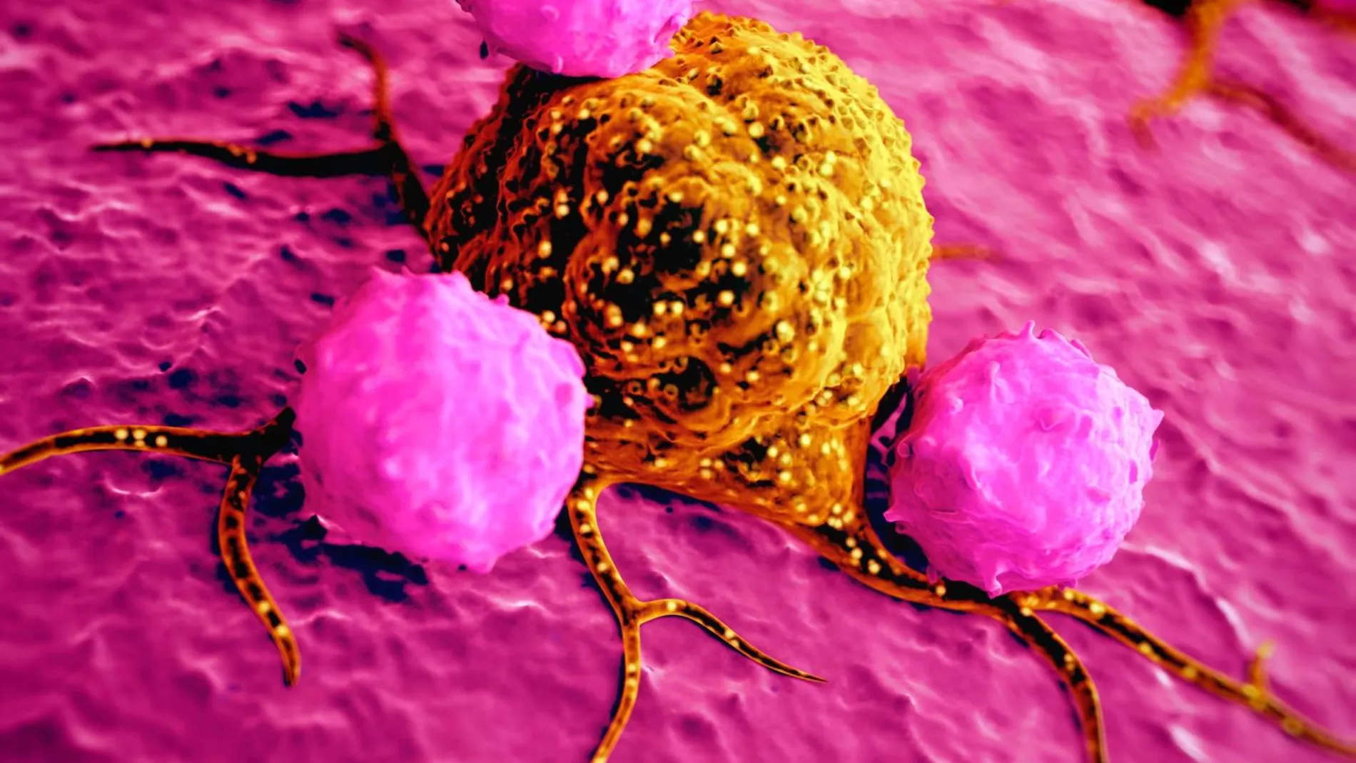 Células cancerosas / Foto: Dreamstime