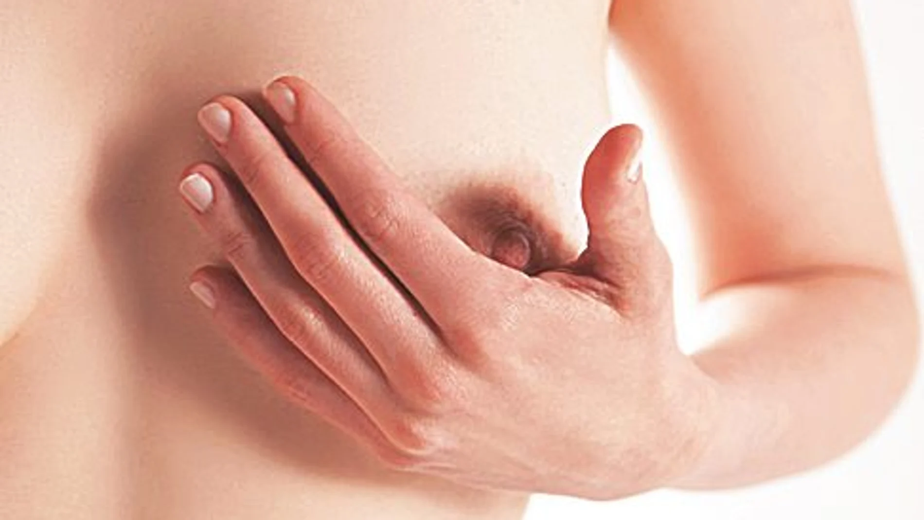Al 35 % de pacientes con cáncer de mama se les tiene que hacer una mastectomía total del pecho