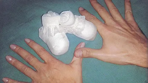 El cáncer de mama en España se sitúa en índices de supervivencia en el 85,2% a los cinco años
