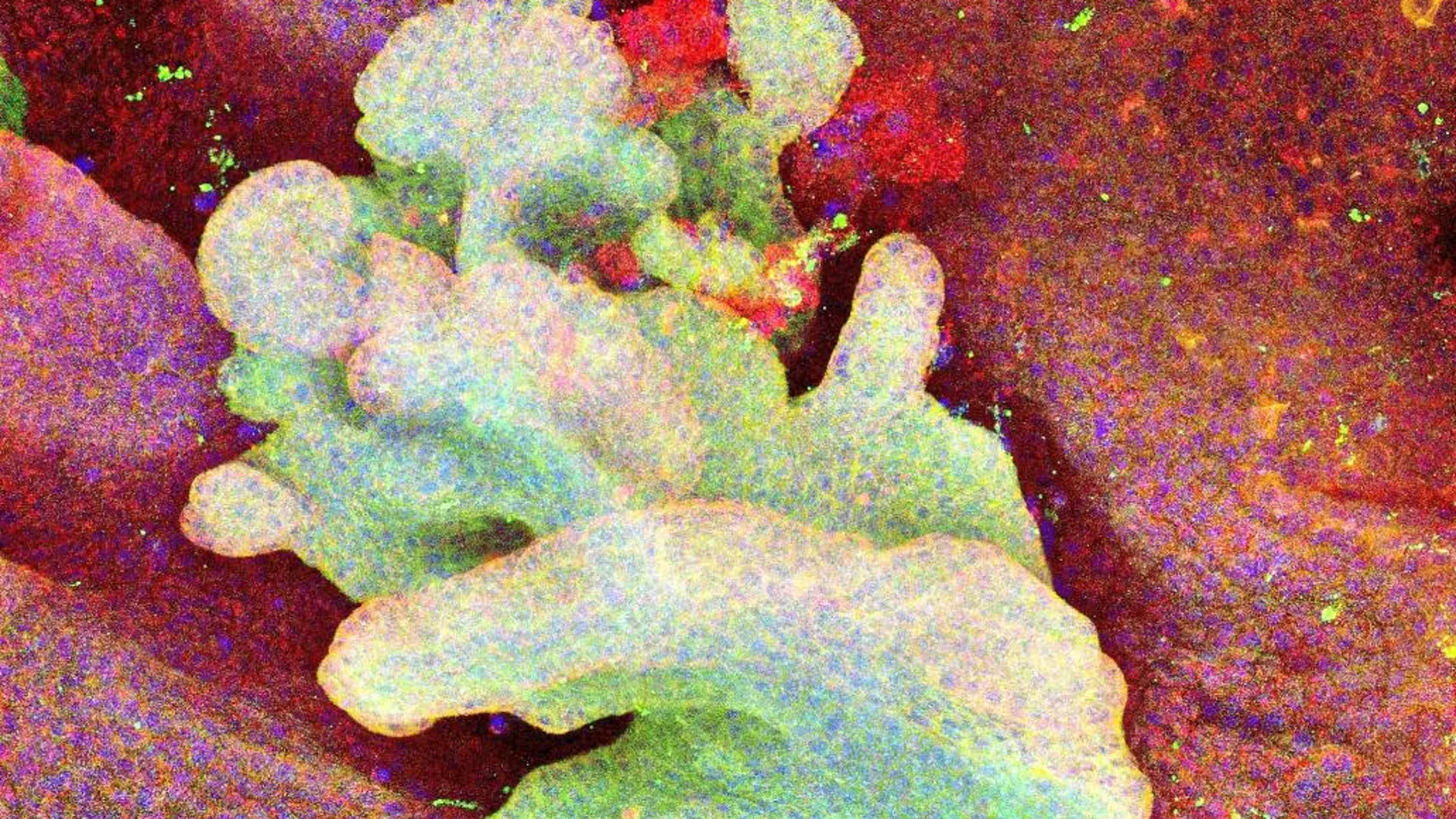 Imagen de las células del carcinoma antes de expandirse en la piel de la cola de un ratón