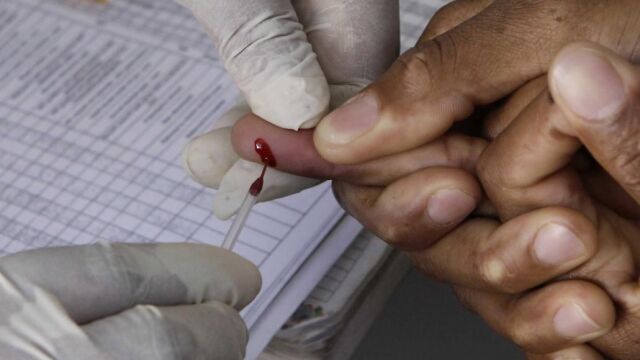 Un paciente se somete a un test del VIH