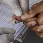 Un paciente se somete a un test del VIH