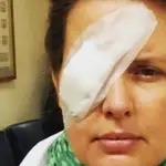  Tania Llasera, herida en un ojo