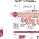Las claves de la patología