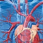 Un tercio menos de muertes por insuficiencia cardiaca