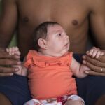 Un estudio vincula el zika con problemas auditivos en algunos niños nacidos de madres infectadas