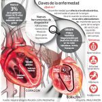 Nuevo método de diagnóstico de la estenosis aórtica en personas mayores