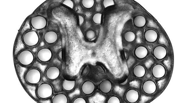 Un implante de dos milímetros impreso en 3D