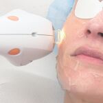 Desarrollan técnicas para el rejuvenecimiento facial sin cirugía con resultados sin precedentes | Imagen cedida