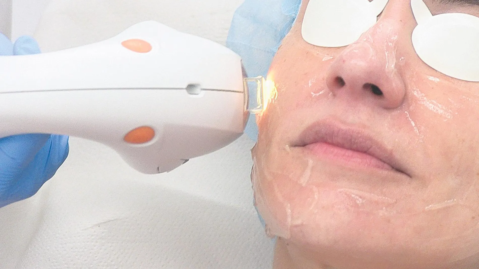 Desarrollan técnicas para el rejuvenecimiento facial sin cirugía con resultados sin precedentes | Imagen cedida