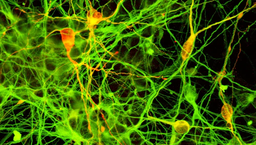 En el cerebro no solo hay neuronas, también conviven otros tipos de células como las células gliales, implicadas en inflamación. En la imagen, muestra de tejido neuronal humano.