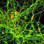 En el cerebro no solo hay neuronas, también conviven otros tipos de células como las células gliales, implicadas en inflamación. En la imagen, muestra de tejido neuronal humano.